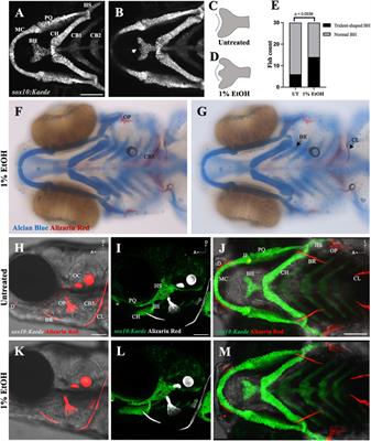 Embryonic ethanol exposure disrupts craniofacial neuromuscular integration in zebrafish larvae